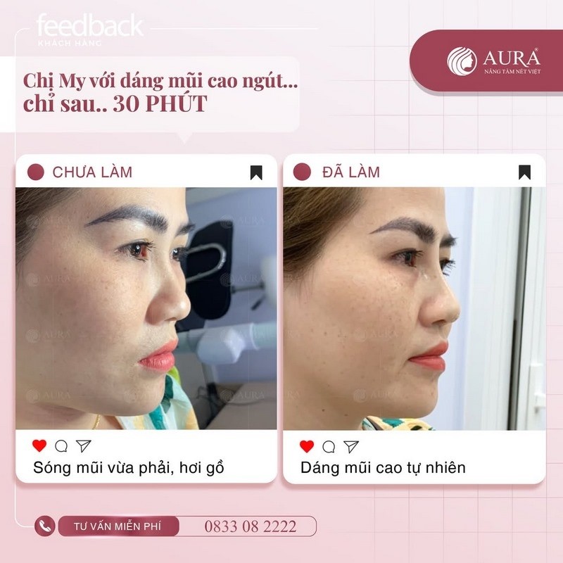 Thẩm mỹ viện Aura