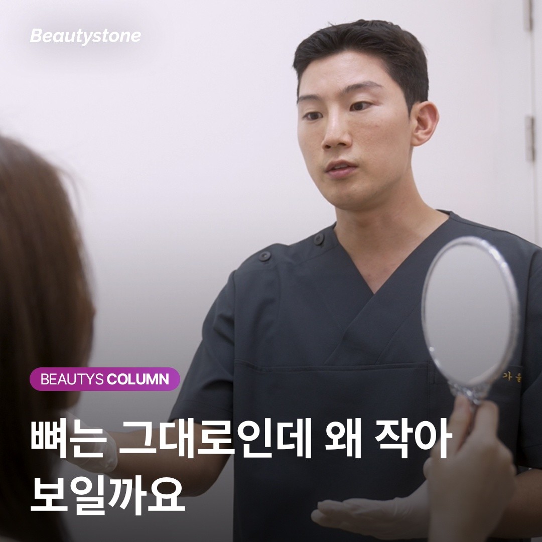 [위영진 칼럼] 턱보톡스 효과 없는 진짜 이유: 뼈와 근육을 구분해야 합니다