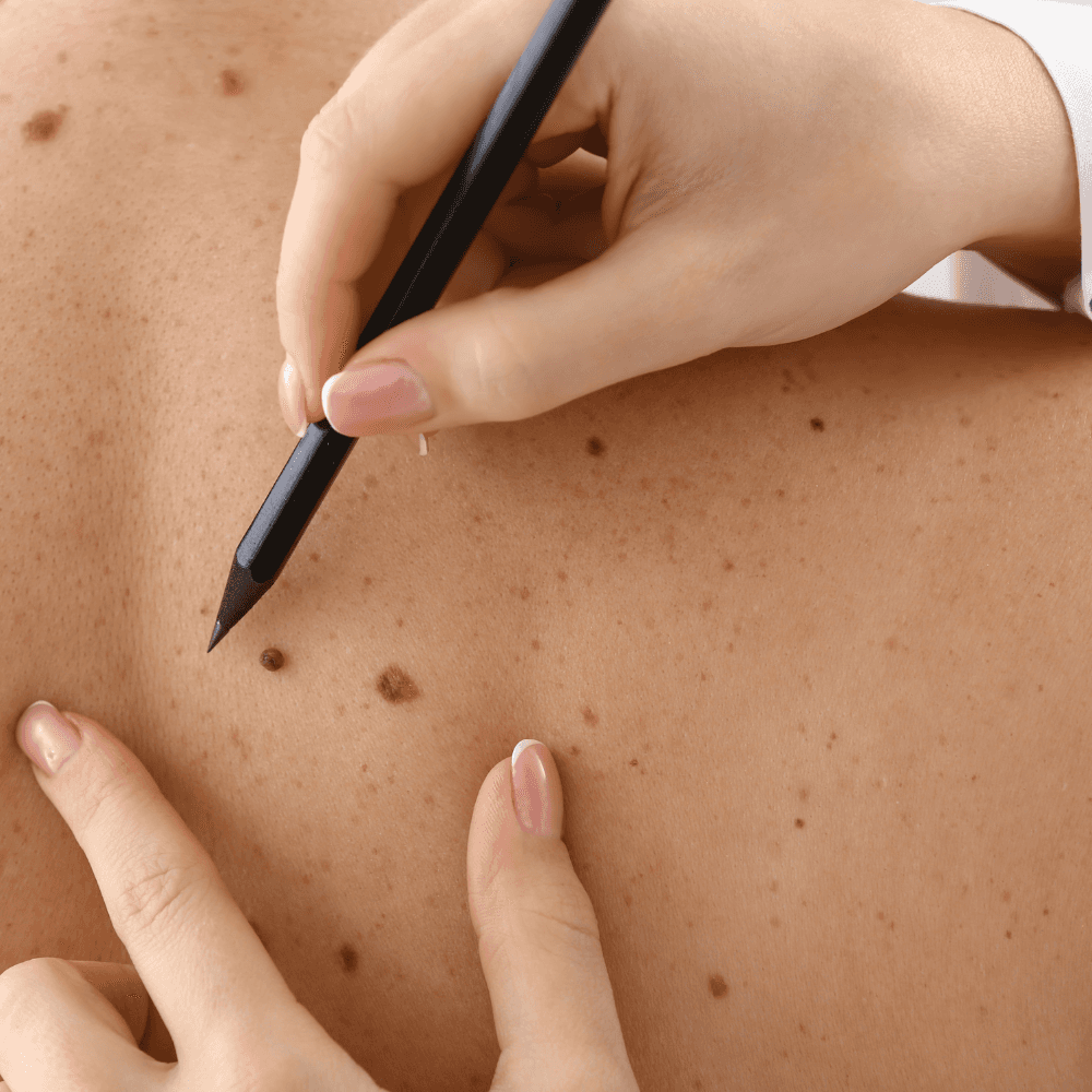 Woman in a towel applying pink under-eye gel patches while looking into a mirror on a vanity table