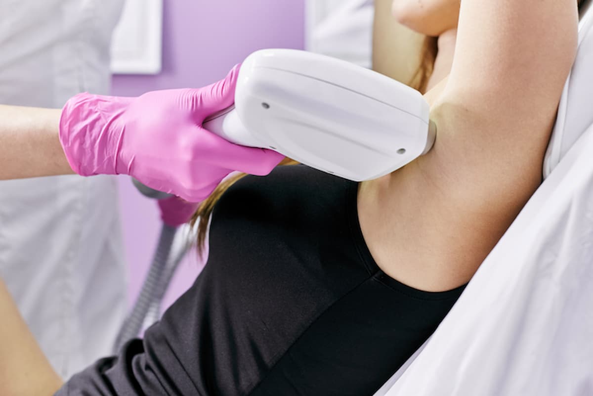 Profissional realizando depilação a laser na axila de uma cliente em clínica estética, ilustrando o funcionamento de uma franquia de depilação.