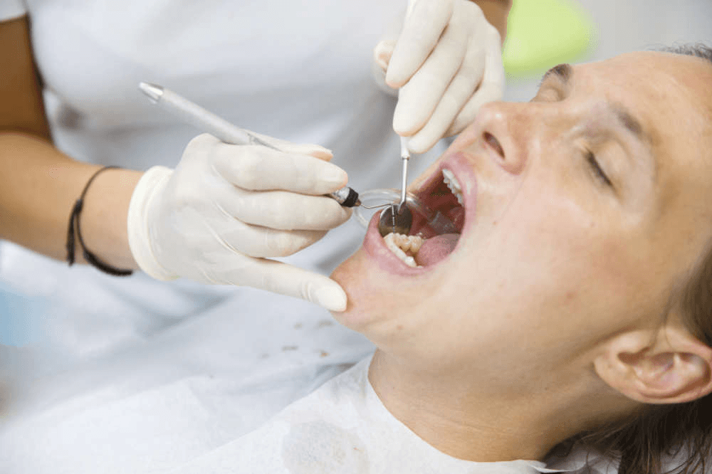 Professional Dental Cleaning