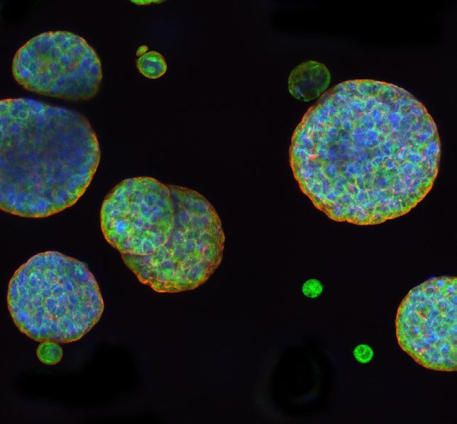 Fluorescence microscopy image of MCF-7 tumour spheroids