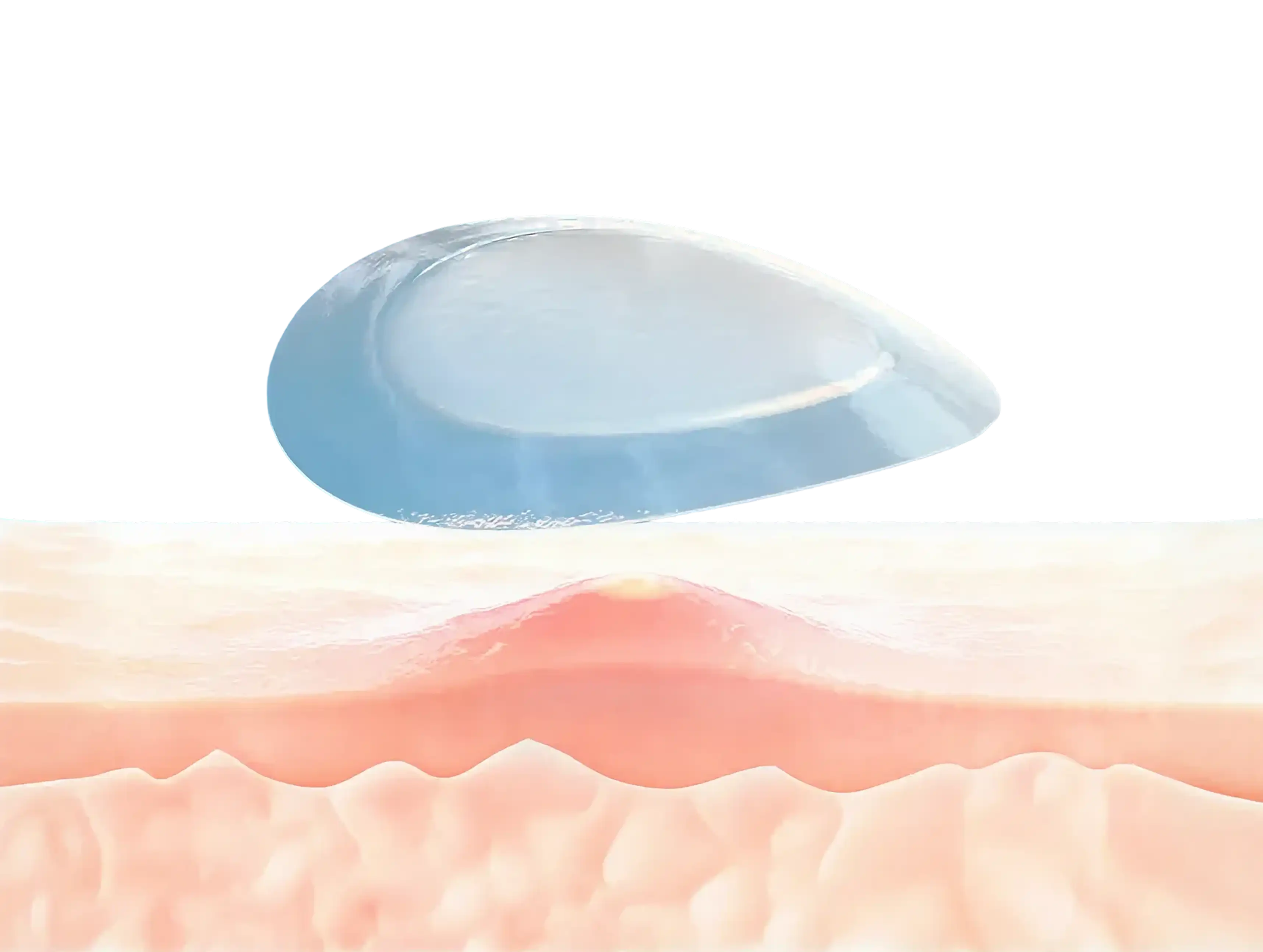 Clinical image right