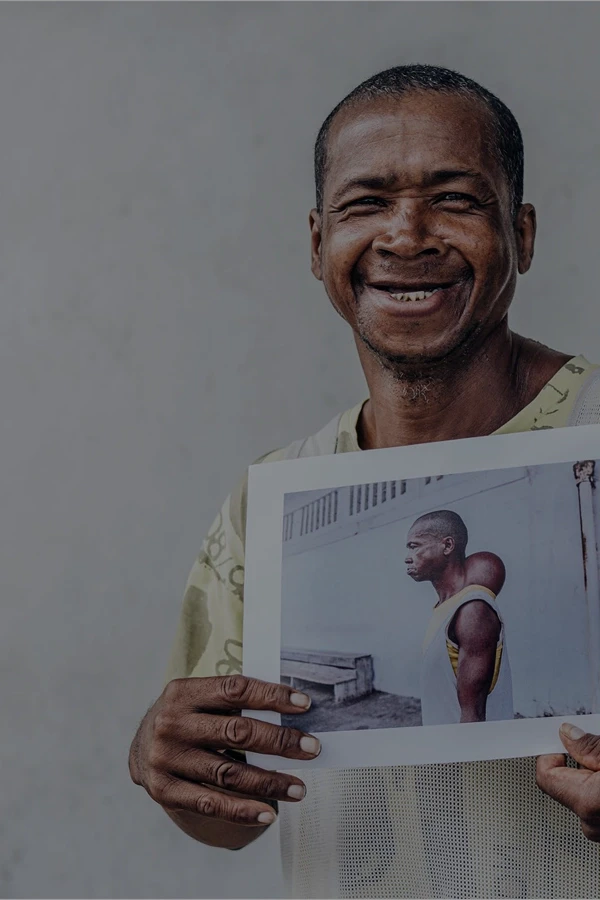 Man smiling and holding a photo of him before the surgery