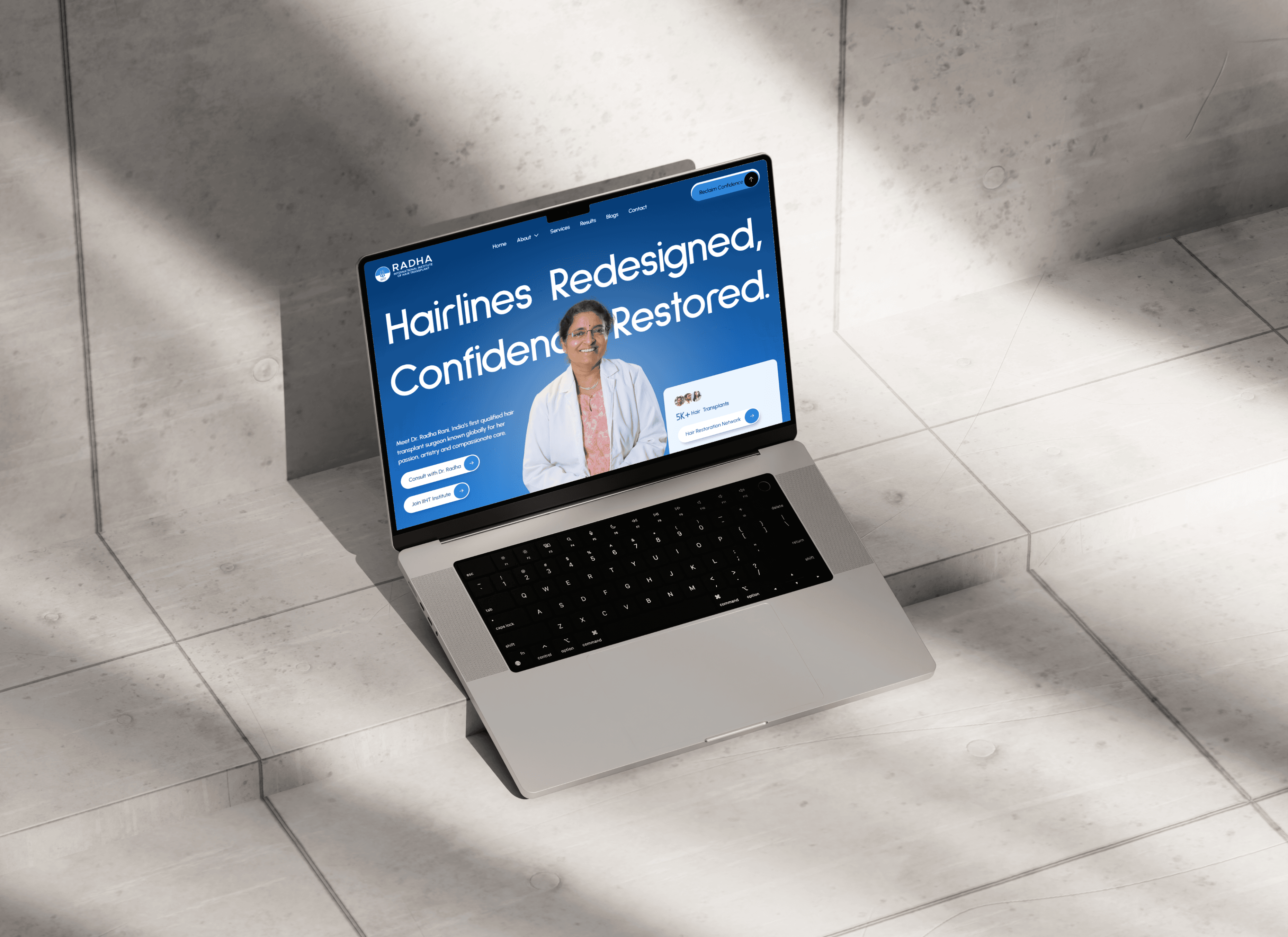 Abstract glitter resin sculpture resembling clustered bubbles on white background—minimal, modern art object.