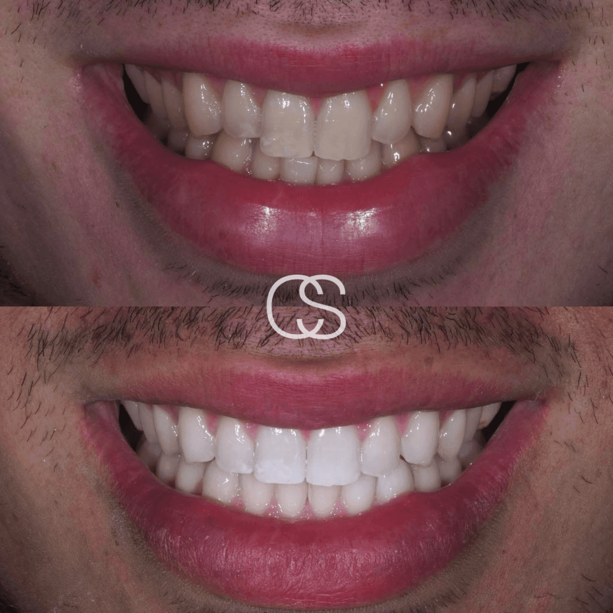 Before & After