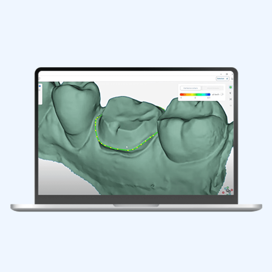Feature Image