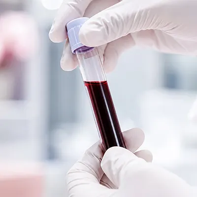 Lockeroom advanced bloodwork and biomarker testing