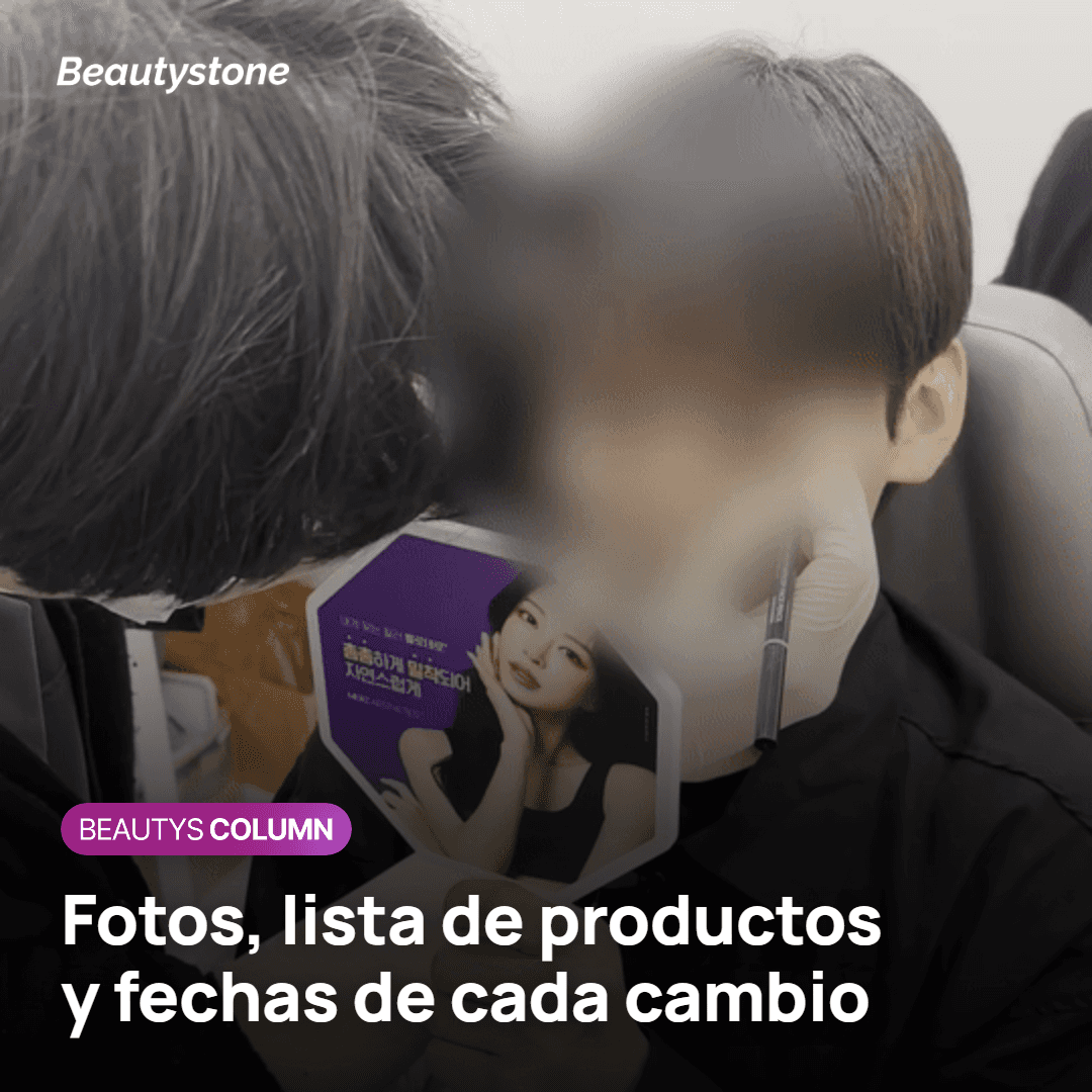 Fotos, lista de productos y señales que indican cuándo pedir una revisión