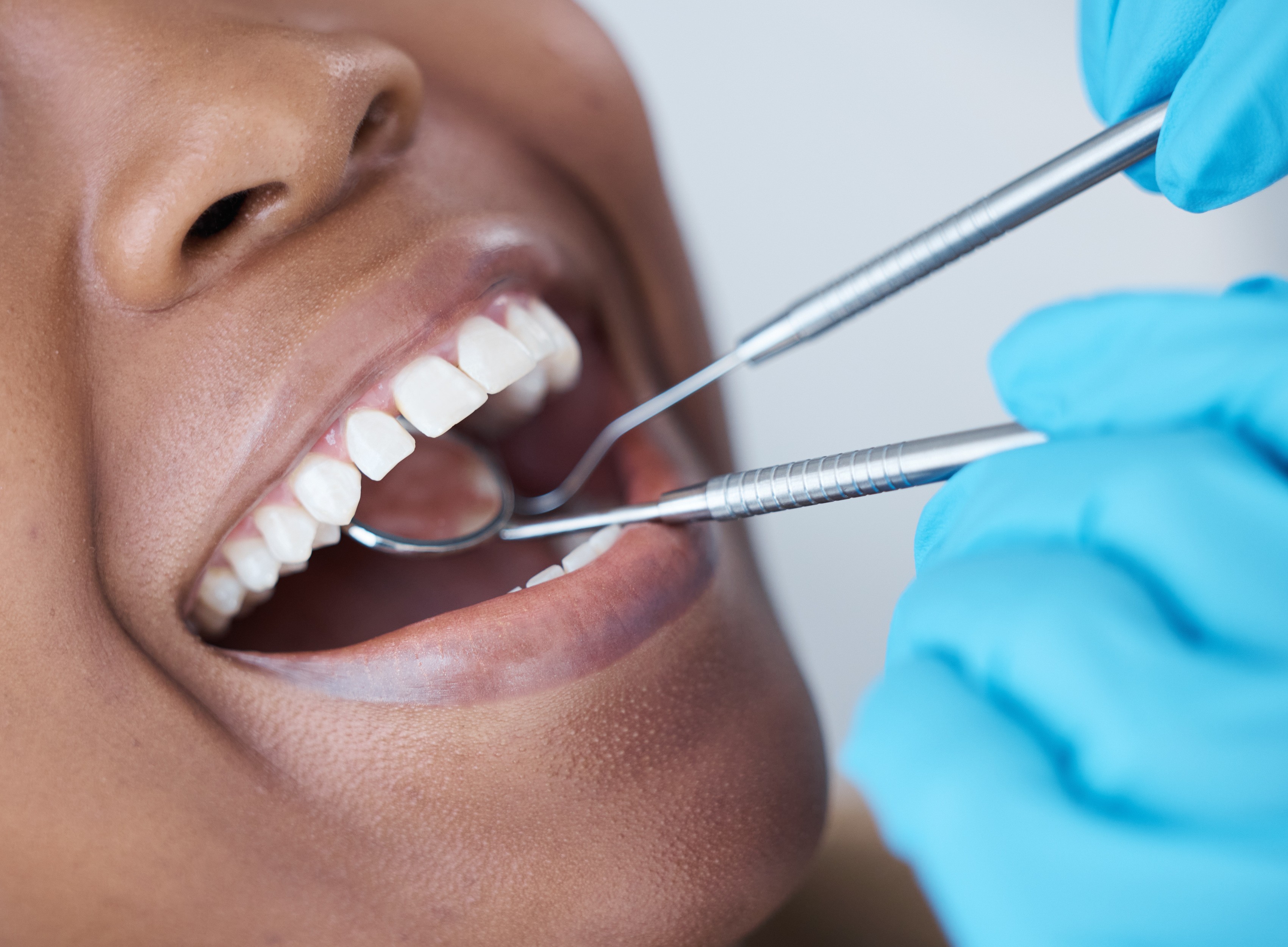 teeth inspection