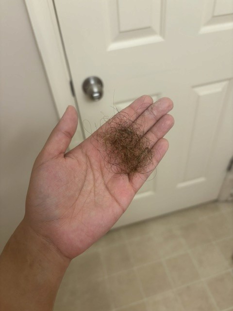 Hair shedding photo