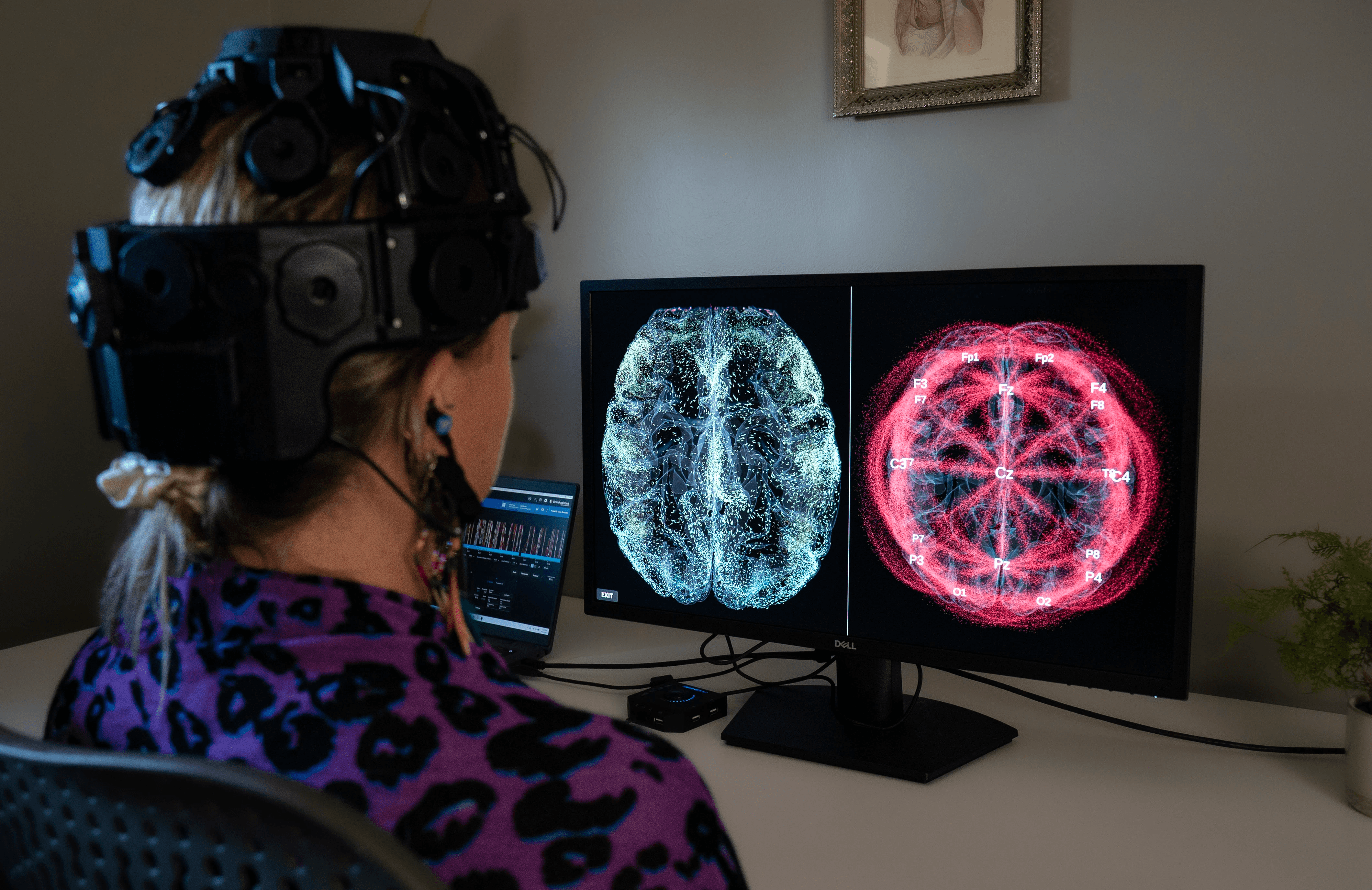 neuro feedback 40 years of zen
