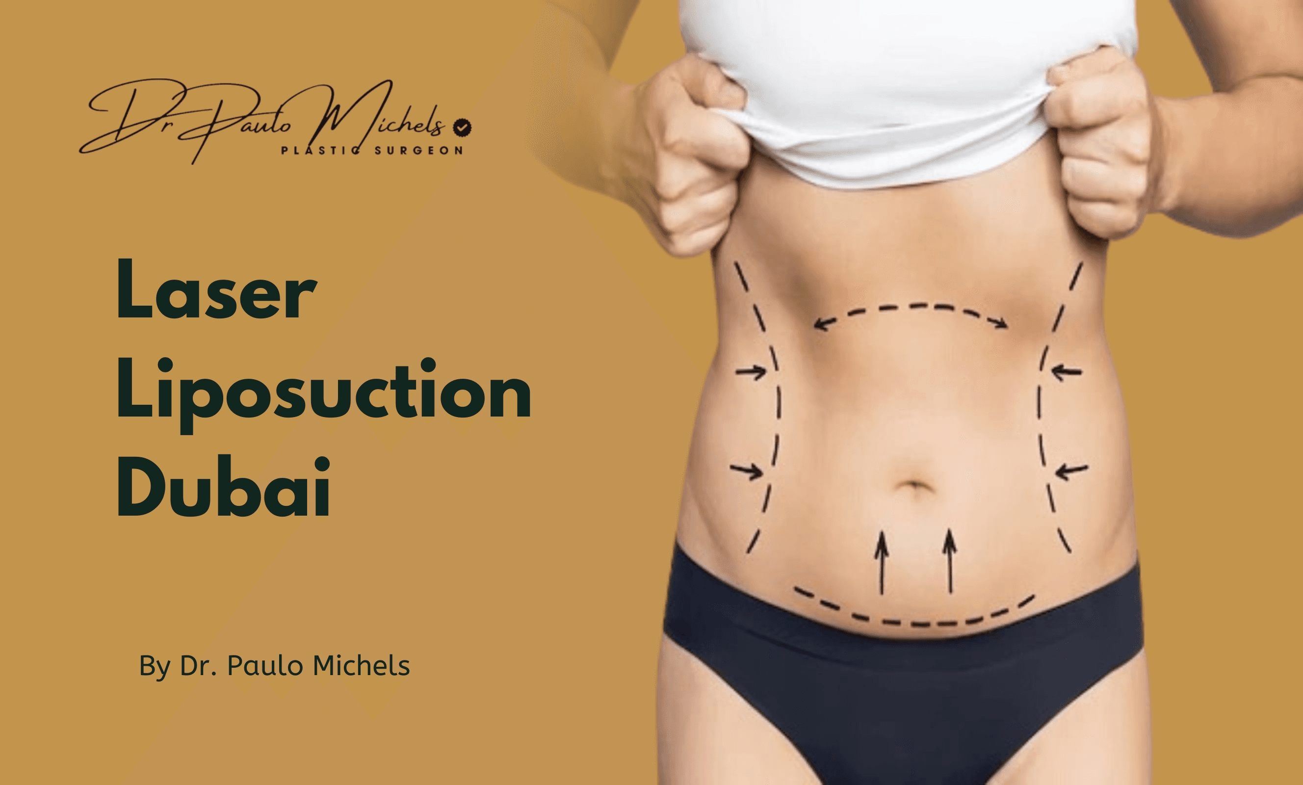 Vaser Liposuction in Abu Dhabi