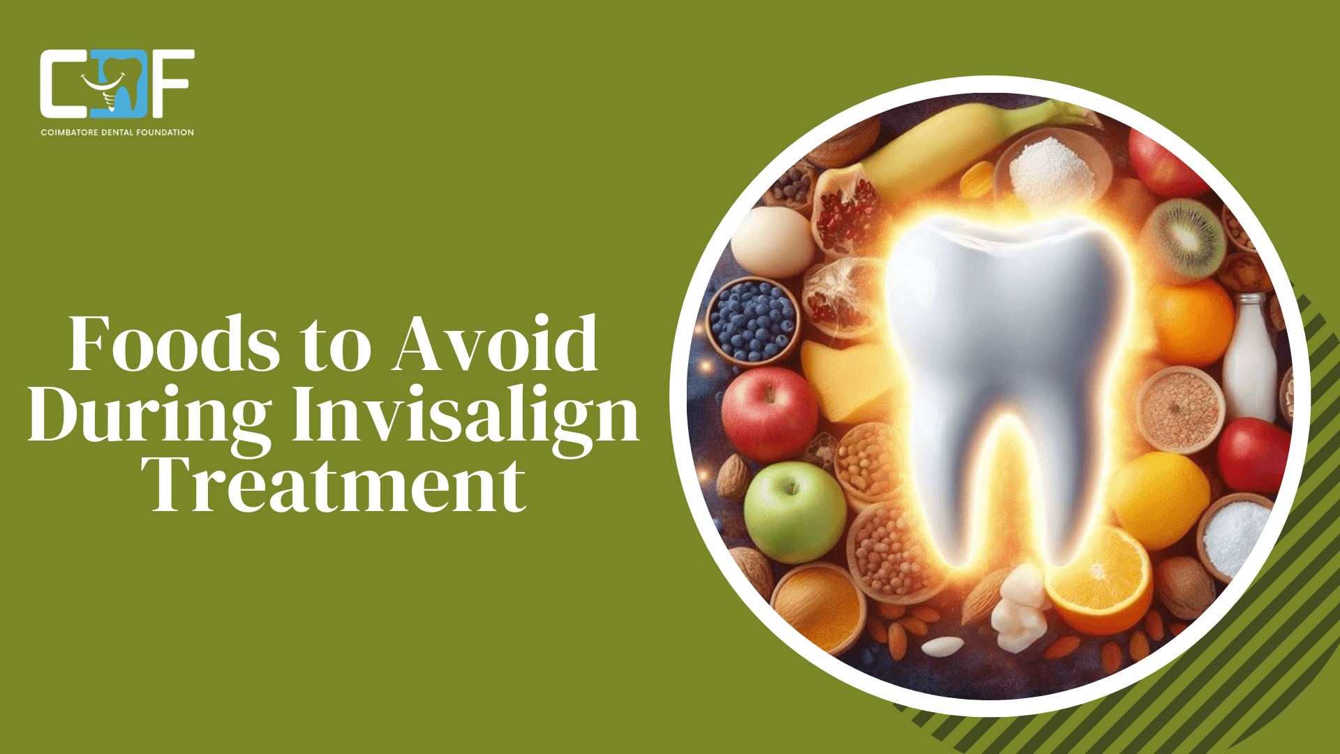 Invisalign Treatment