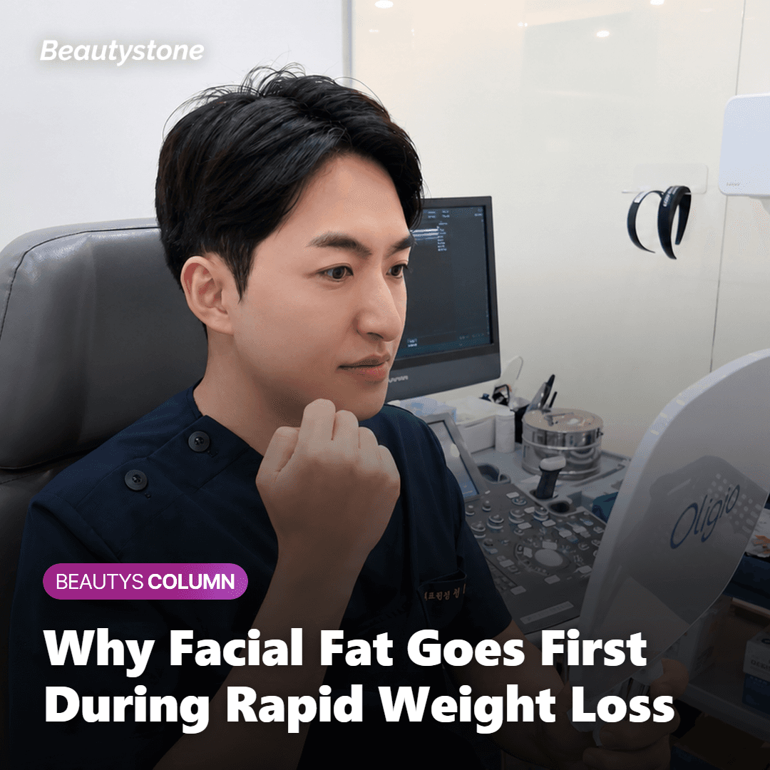 Diagram of facial fat compartments including cheeks, temples, and under-eye zone