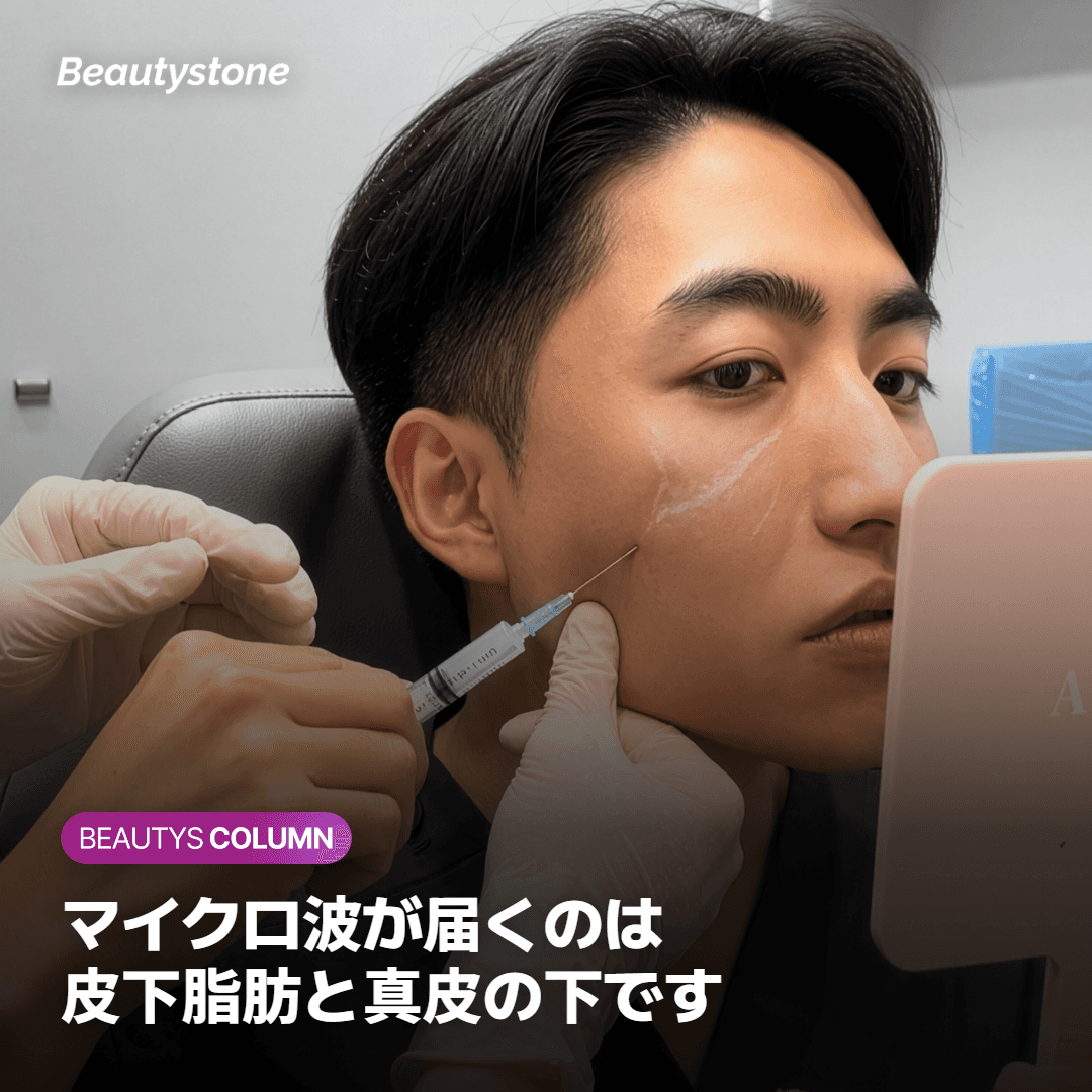 オンダのマイクロ波が皮下脂肪と真皮の下まで届く範囲を示した図