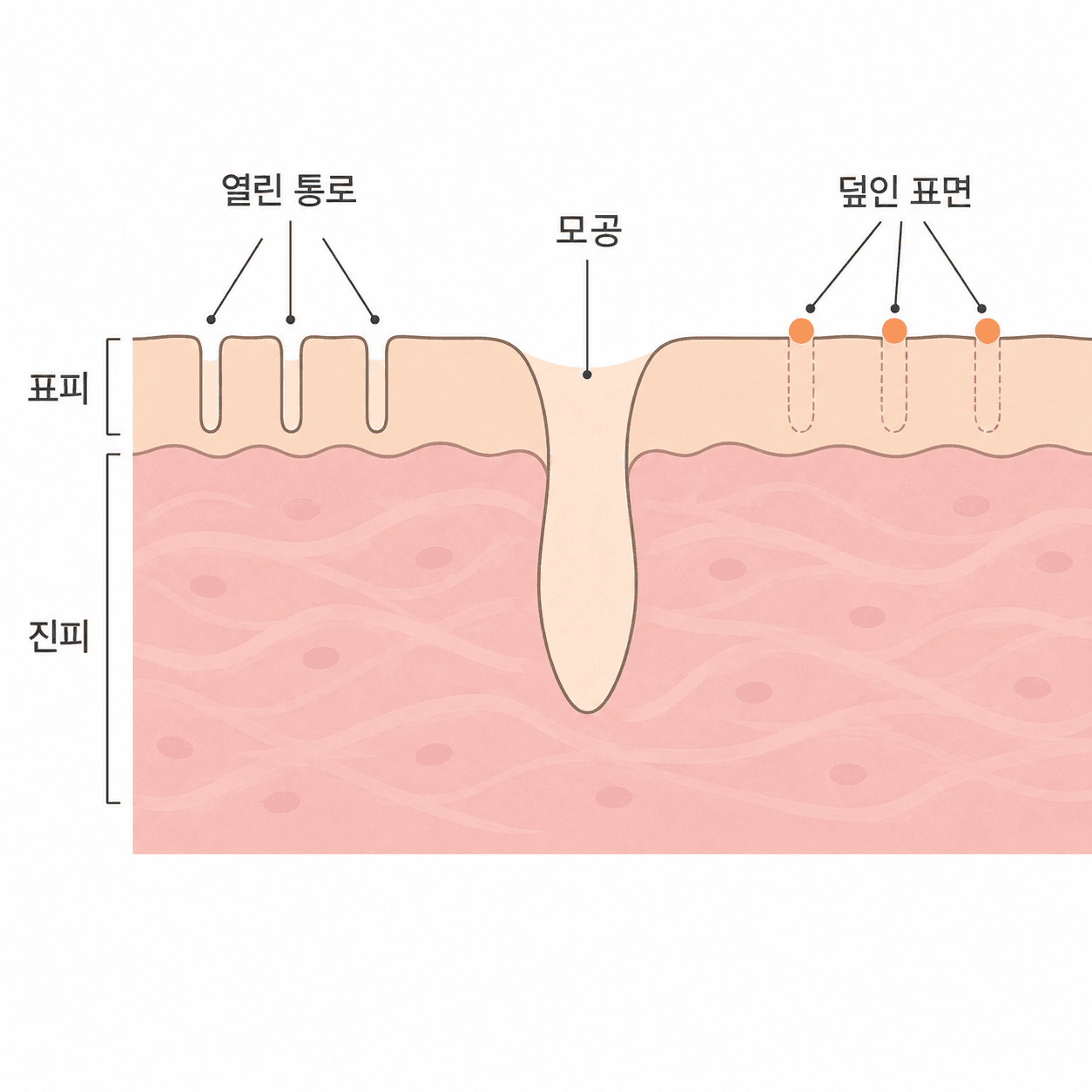 통로가 닫히는 속도와 붉은 기가 가라앉는 속도가 달라요.