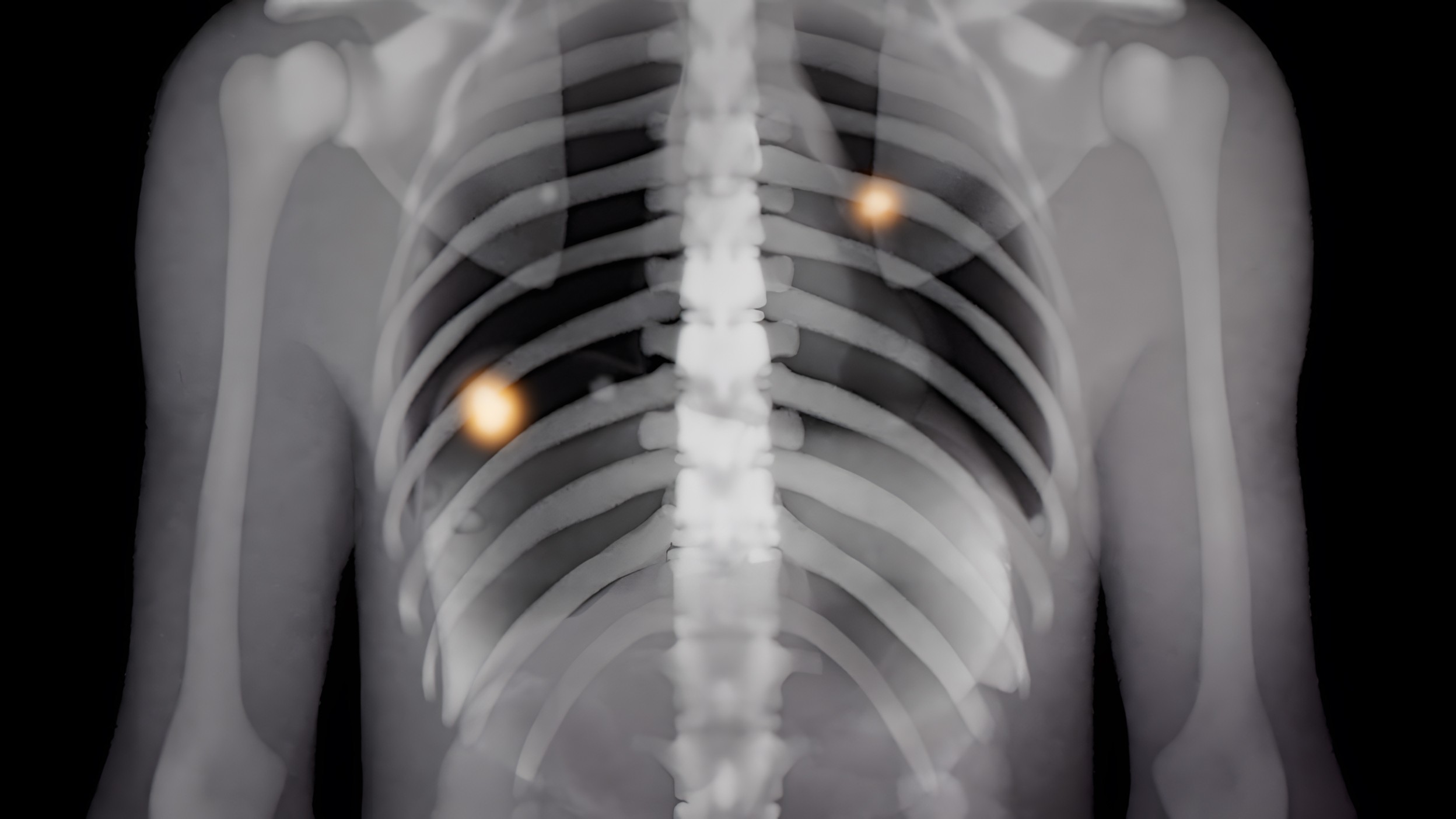 CT Scan Visualization 