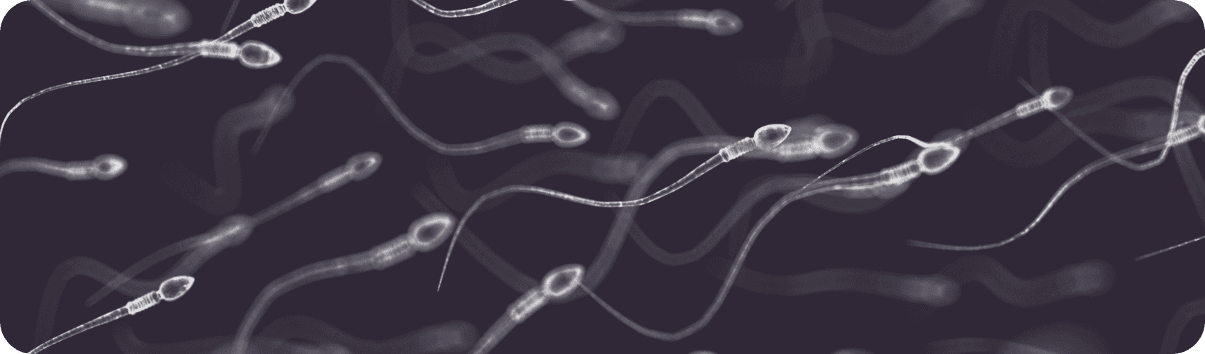 Sperm swimming against a dark navy background