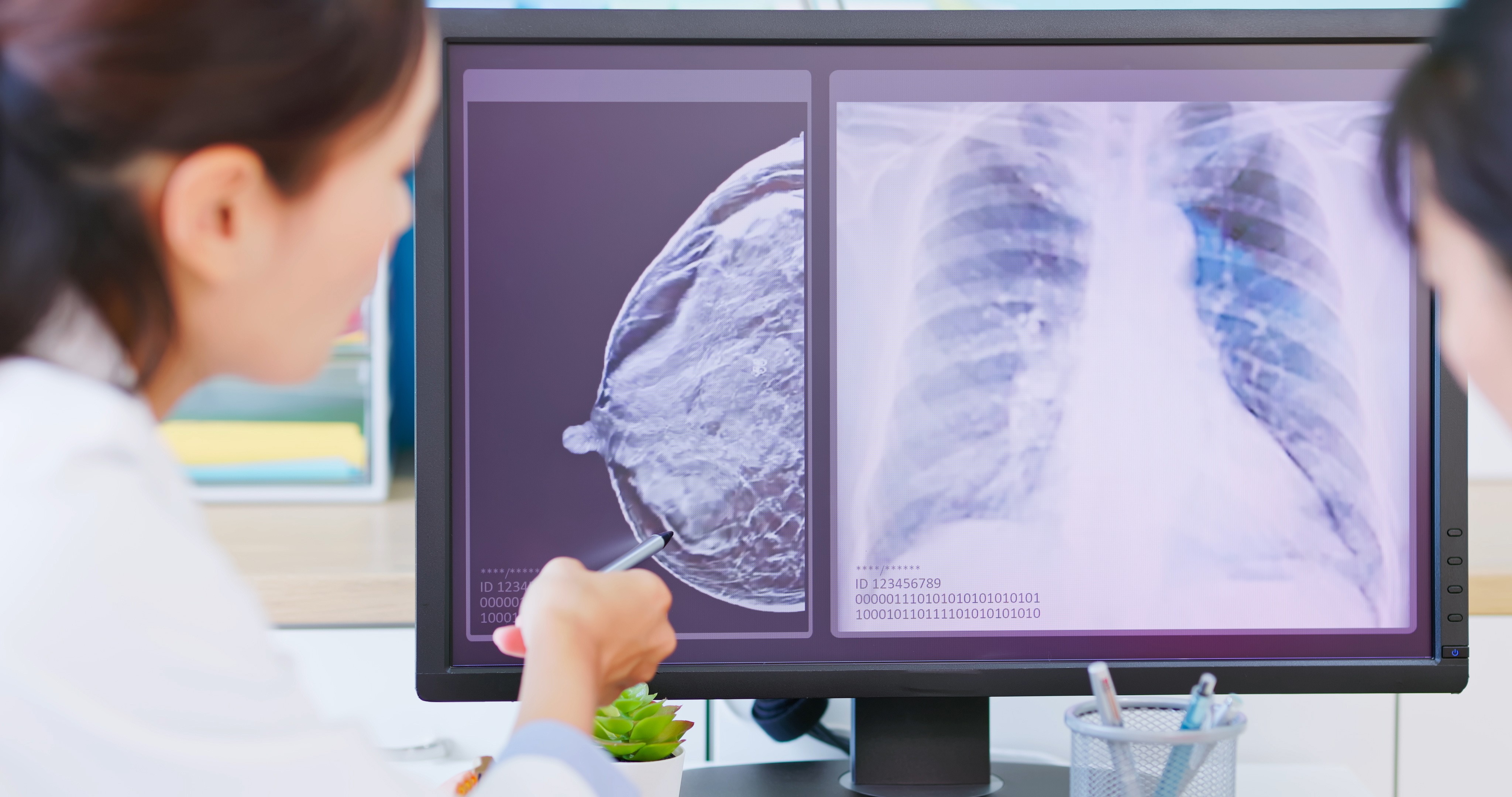 A female medical person pointing at a screen showing a scan of the side of a breast, pointing at a specific section of the scan.