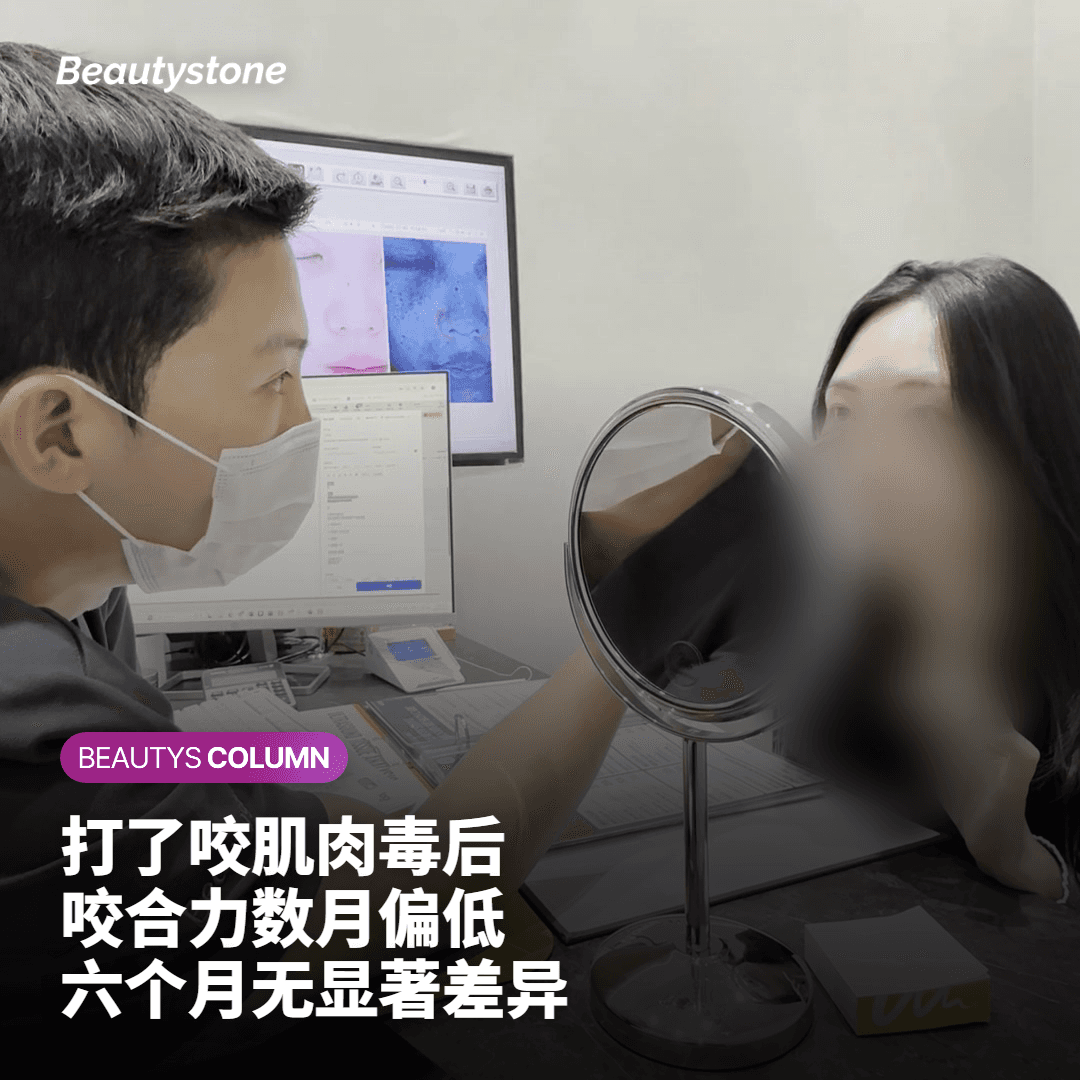 方形脸肉毒杆菌素副作用报告比例（80 人）