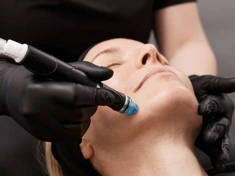 Close-up of Hydrafacial wand cleansing a patient's jawline.