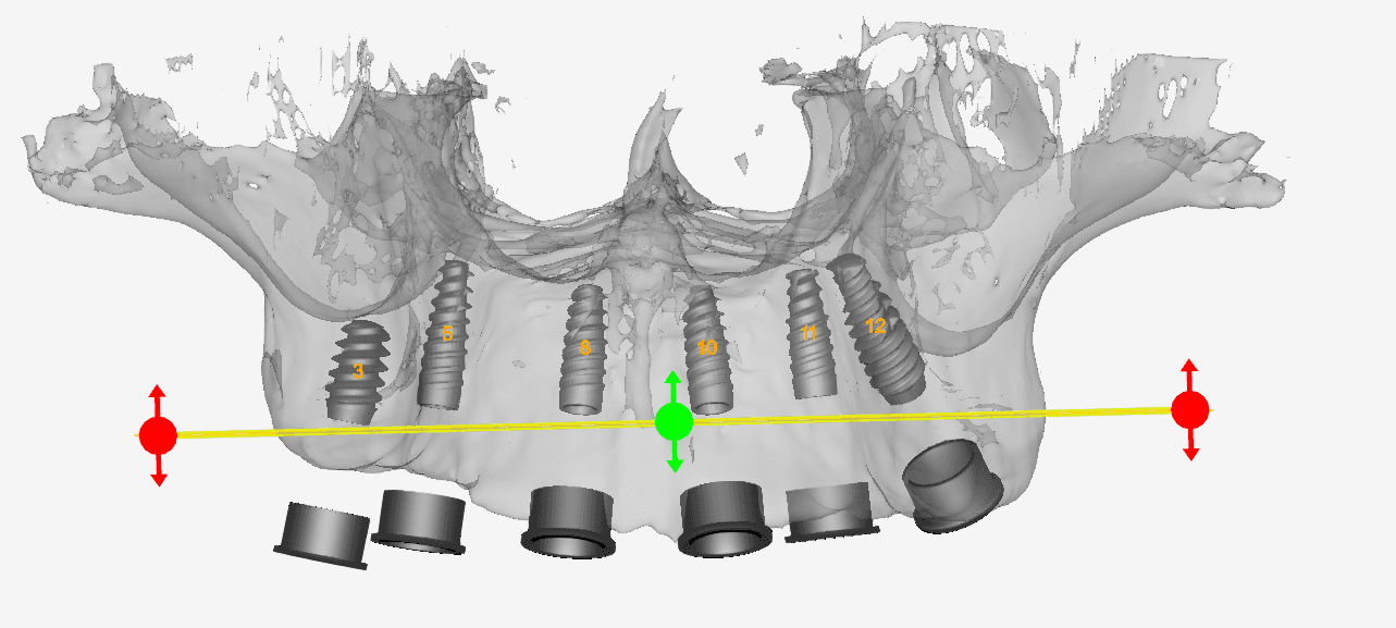 Digital Treatment Planning