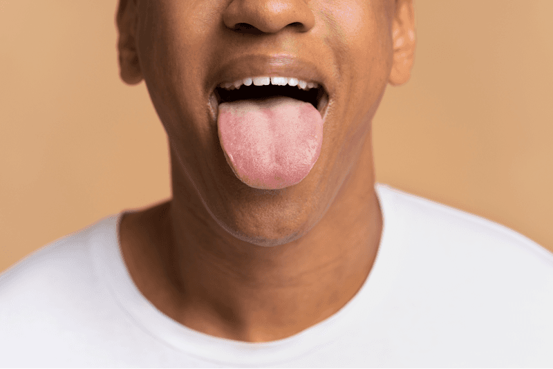 Patient showing tongue