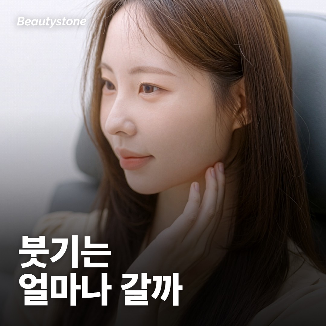 맞고 붓기 며칠 가요?