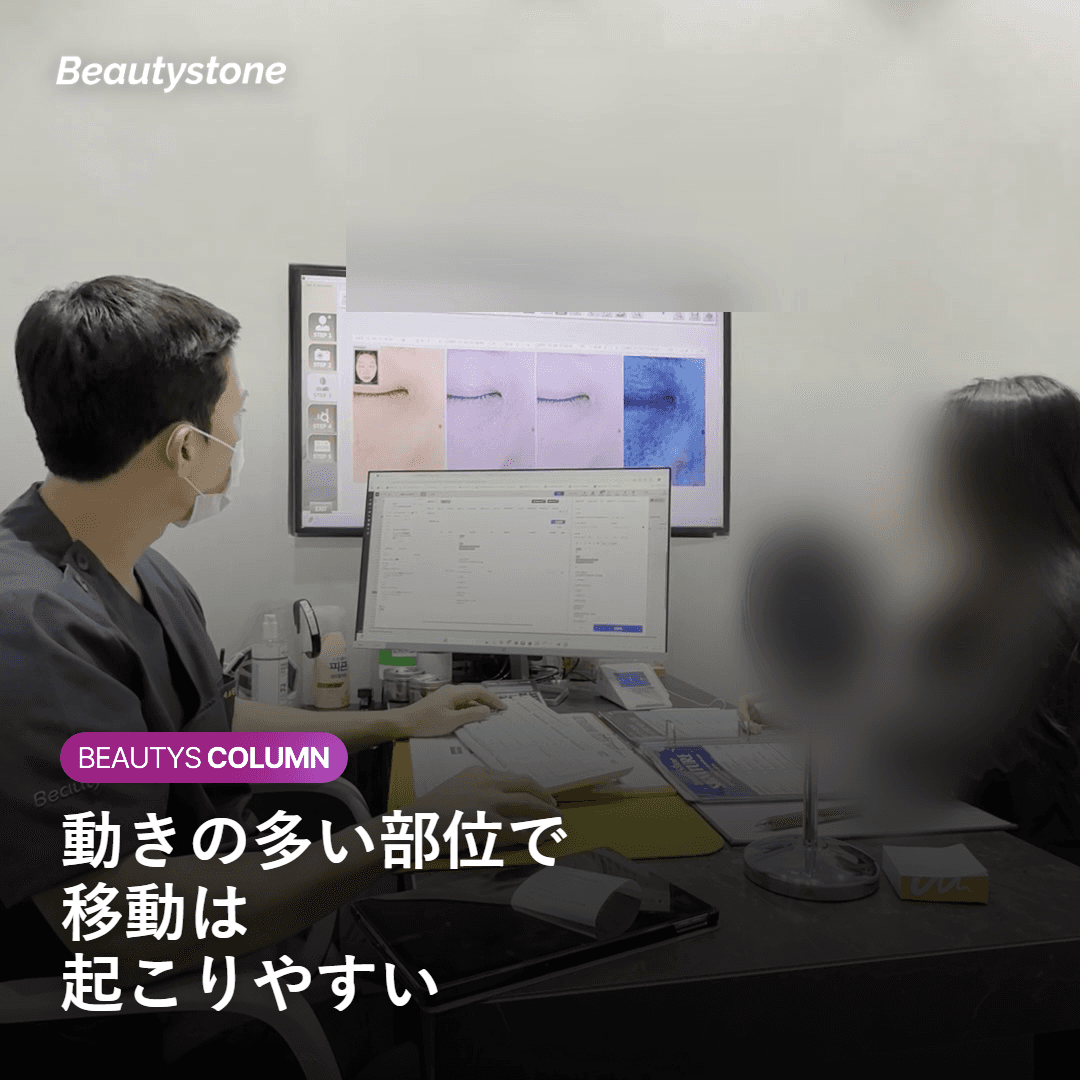 移動が起こりやすい部位と条件を示す図