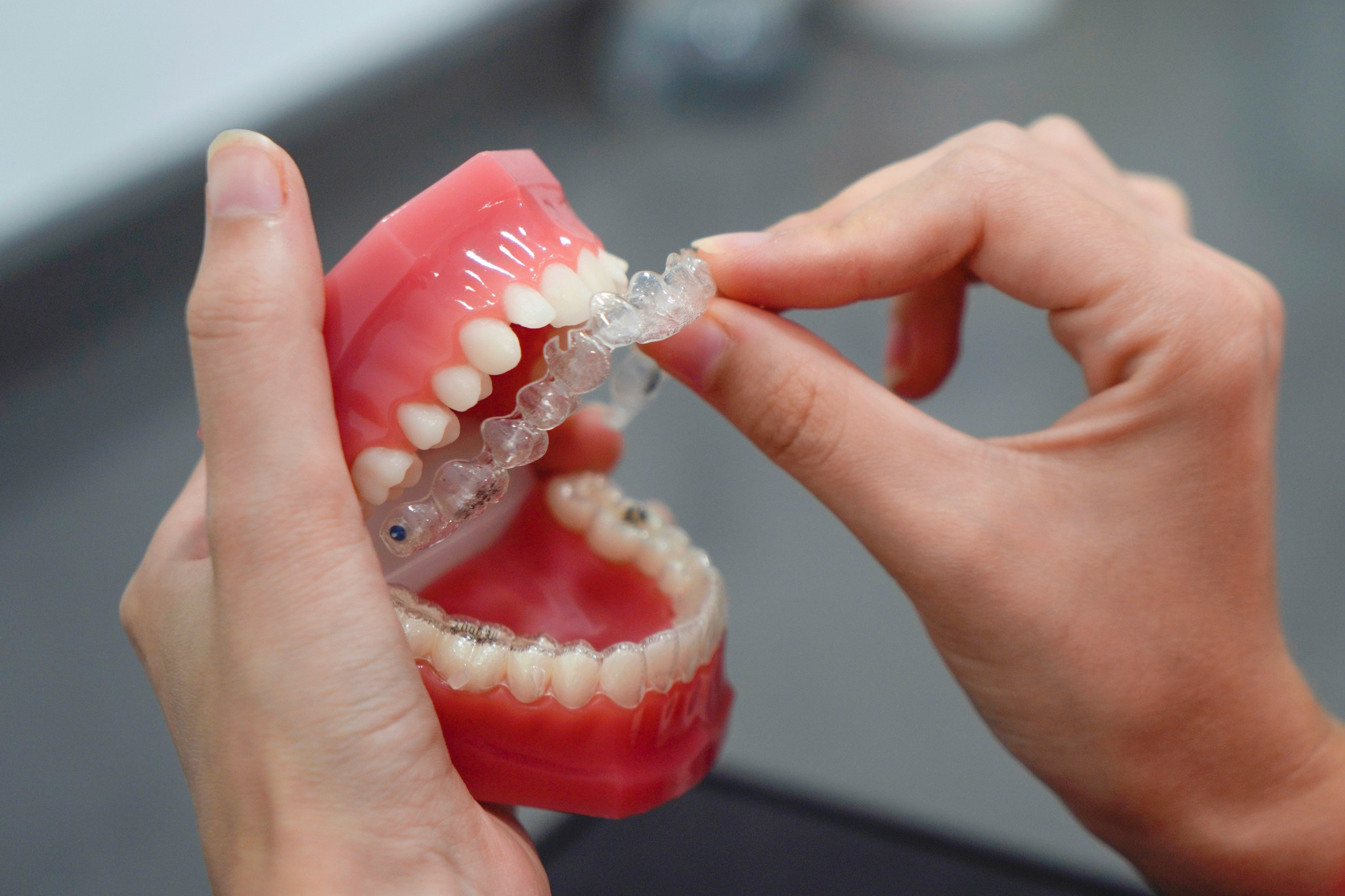 invisalign dental treatment