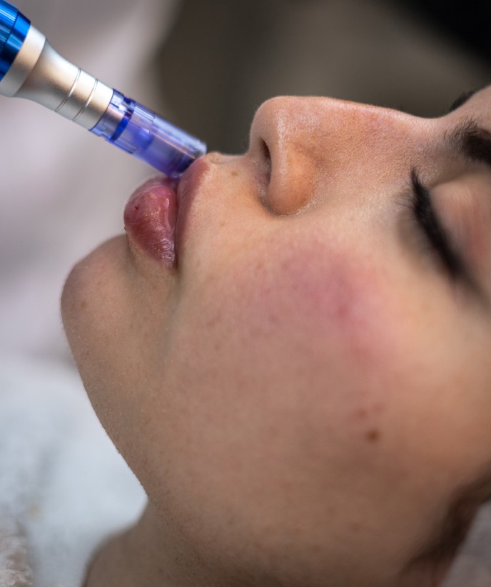 Lip filler injection in Abu Dhabi. 