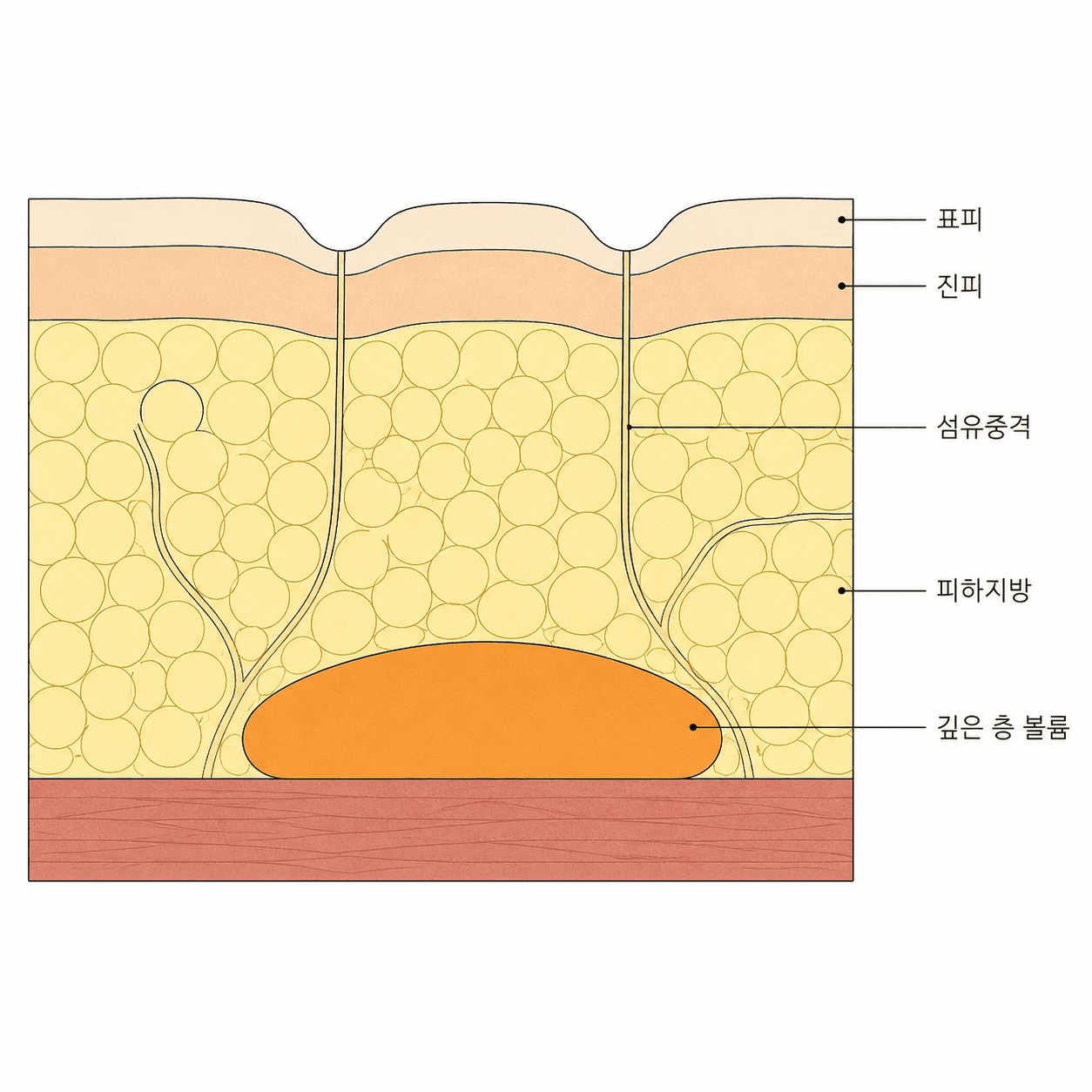 표면을 끌어내리는 줄과 볼륨이 놓이는 자리는 서로 다른 높이에 있어요.