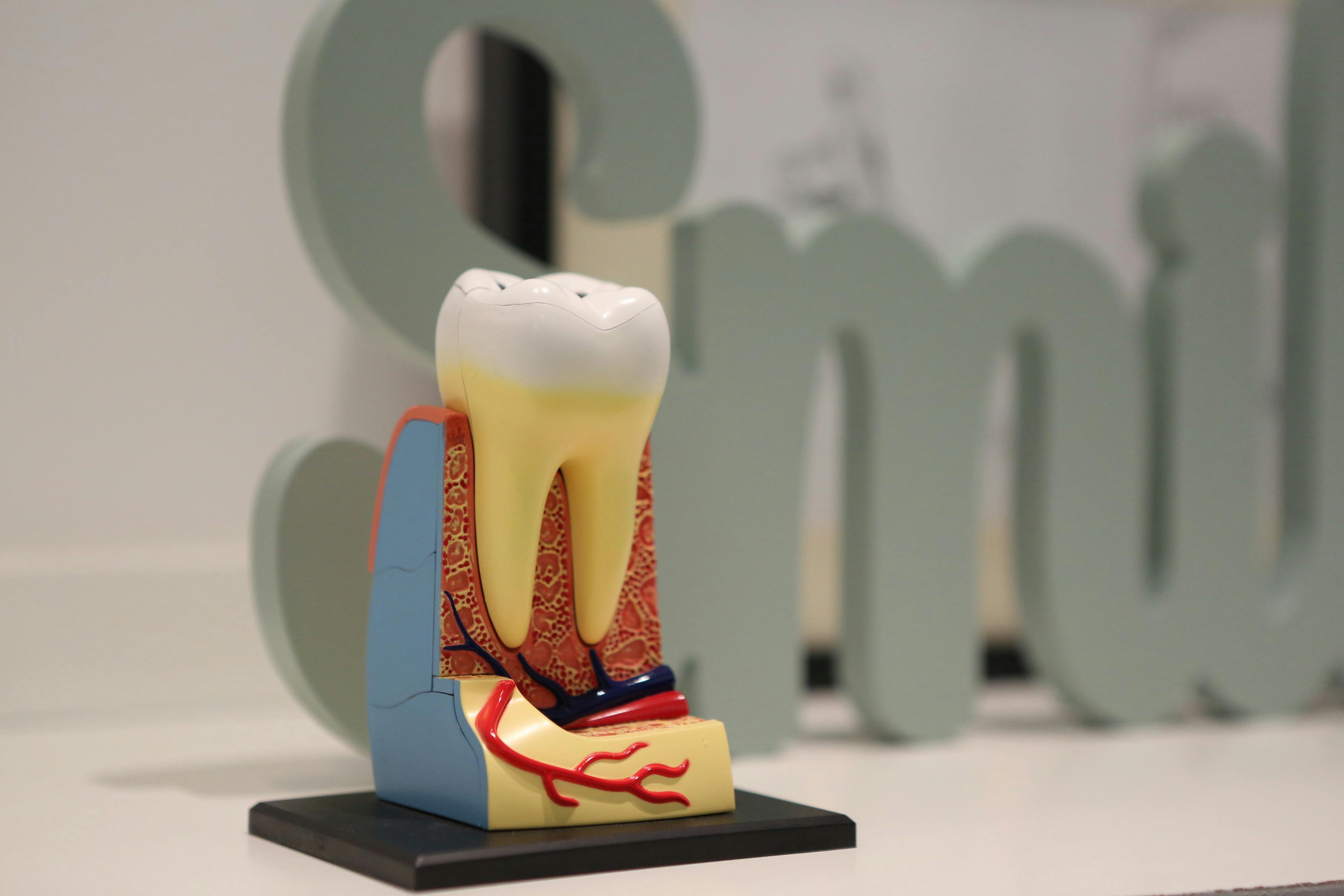 root canal