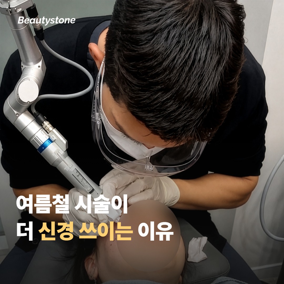 여름철 시술이 특히 신경 쓰이는 이유