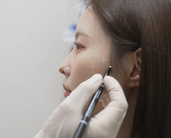 온다리프팅-마이크로웨이브-홍대피부과-뷰티스톤의원