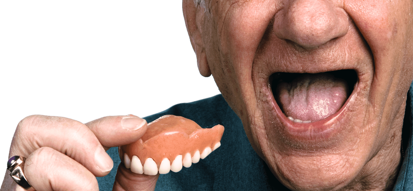 All on 4 Fogászati Implantátum, Teljes Fogsor Reabilitáció - Székelydental Gyergyoszentmiklos