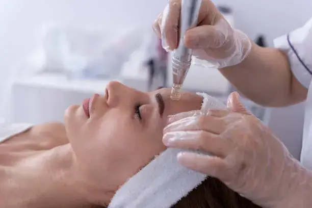 Client receiving microneedling facial treatment to improve skin texture, minimize fine lines, and boost absorption of skincare products.