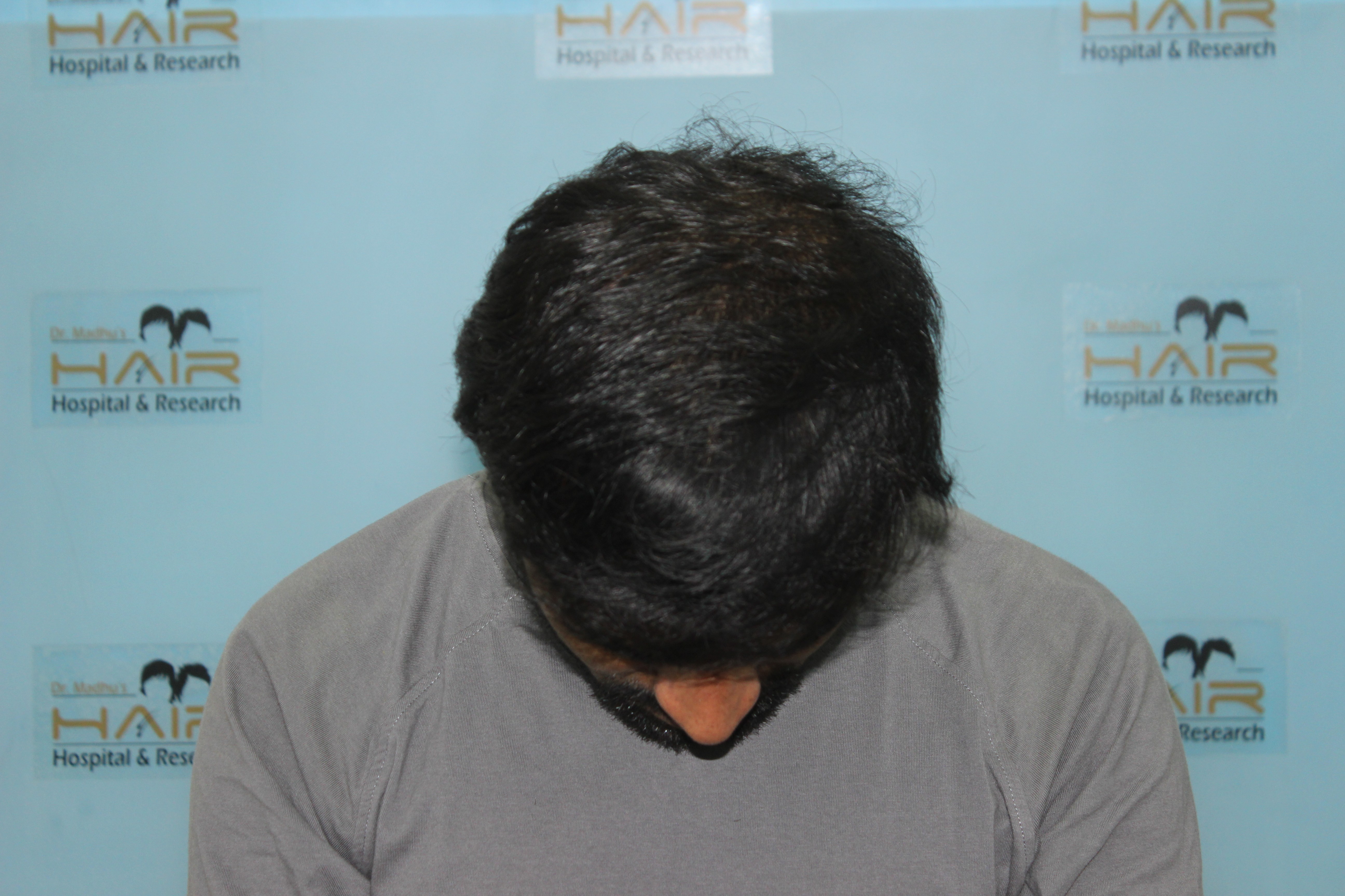 person with red lipstick and red lipstick