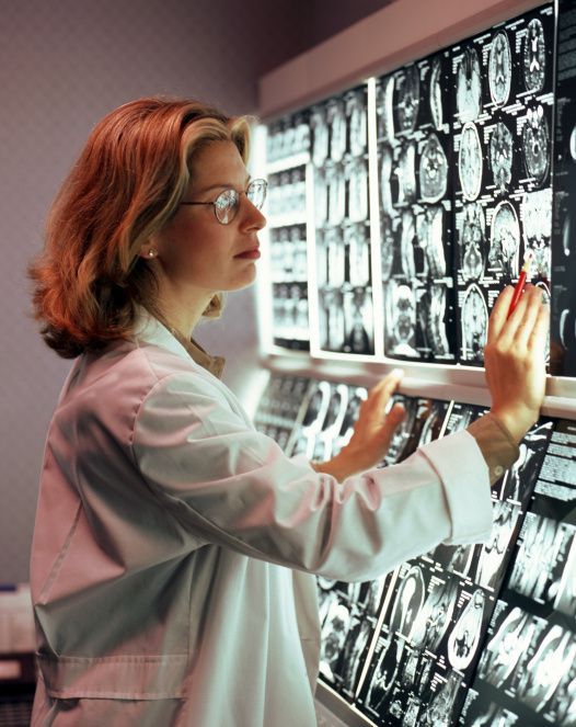 Neurologist looking at the scan of a Patient