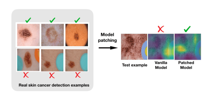 Model patching fixes the subgroup performance gap between images of malignant lesions with and without colored bandages.