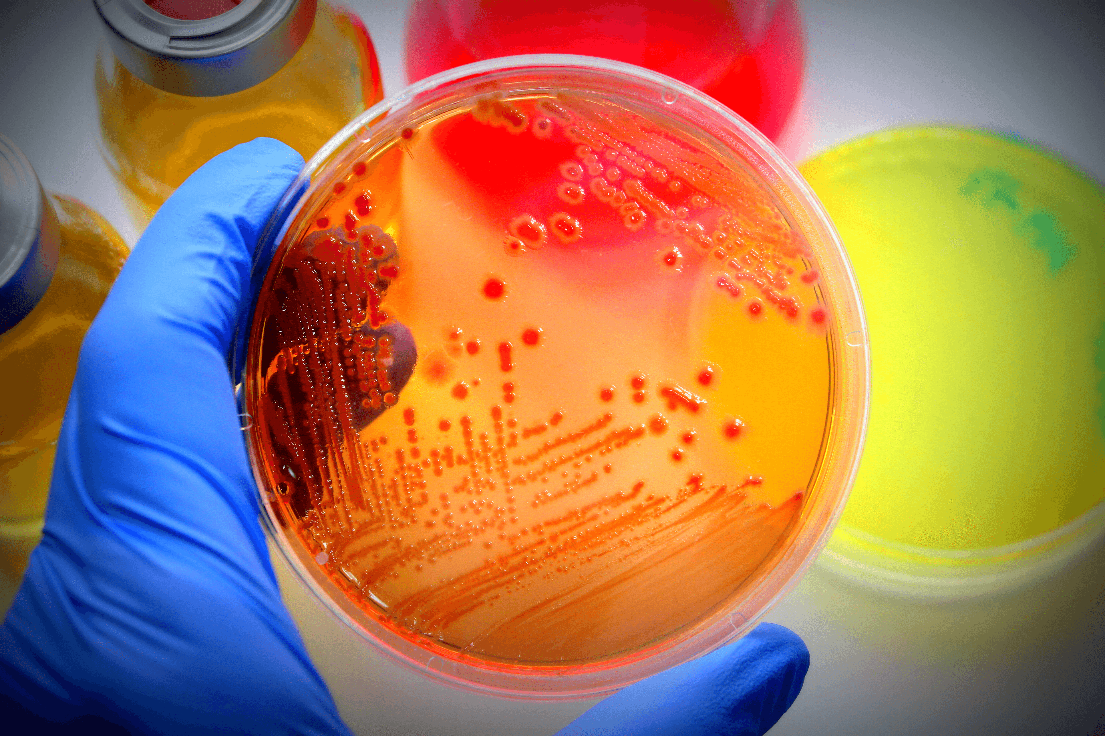 High school student examining microbial cultures under a microscope for a microbiology research project