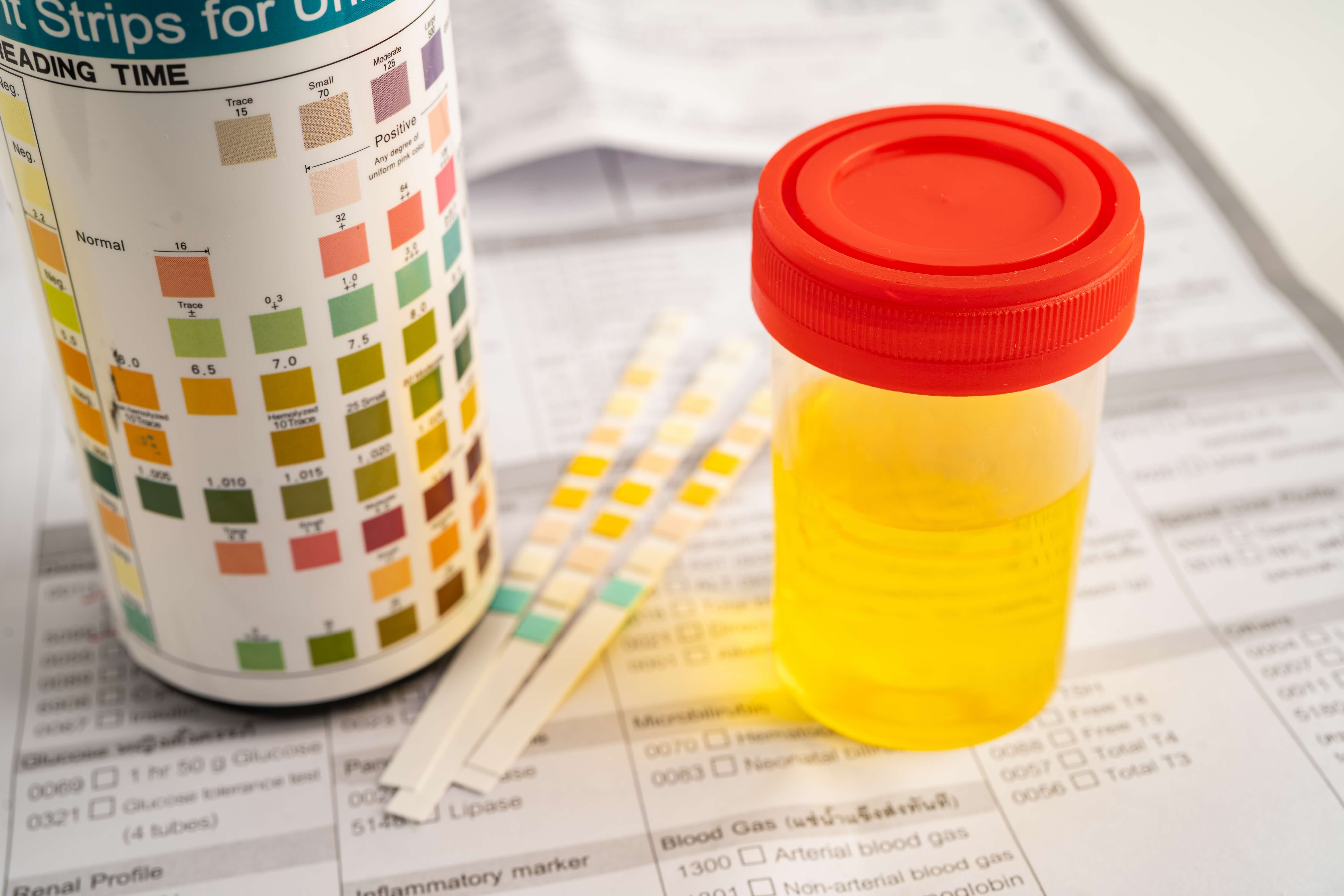 Drug & Alcohol Testing Strips