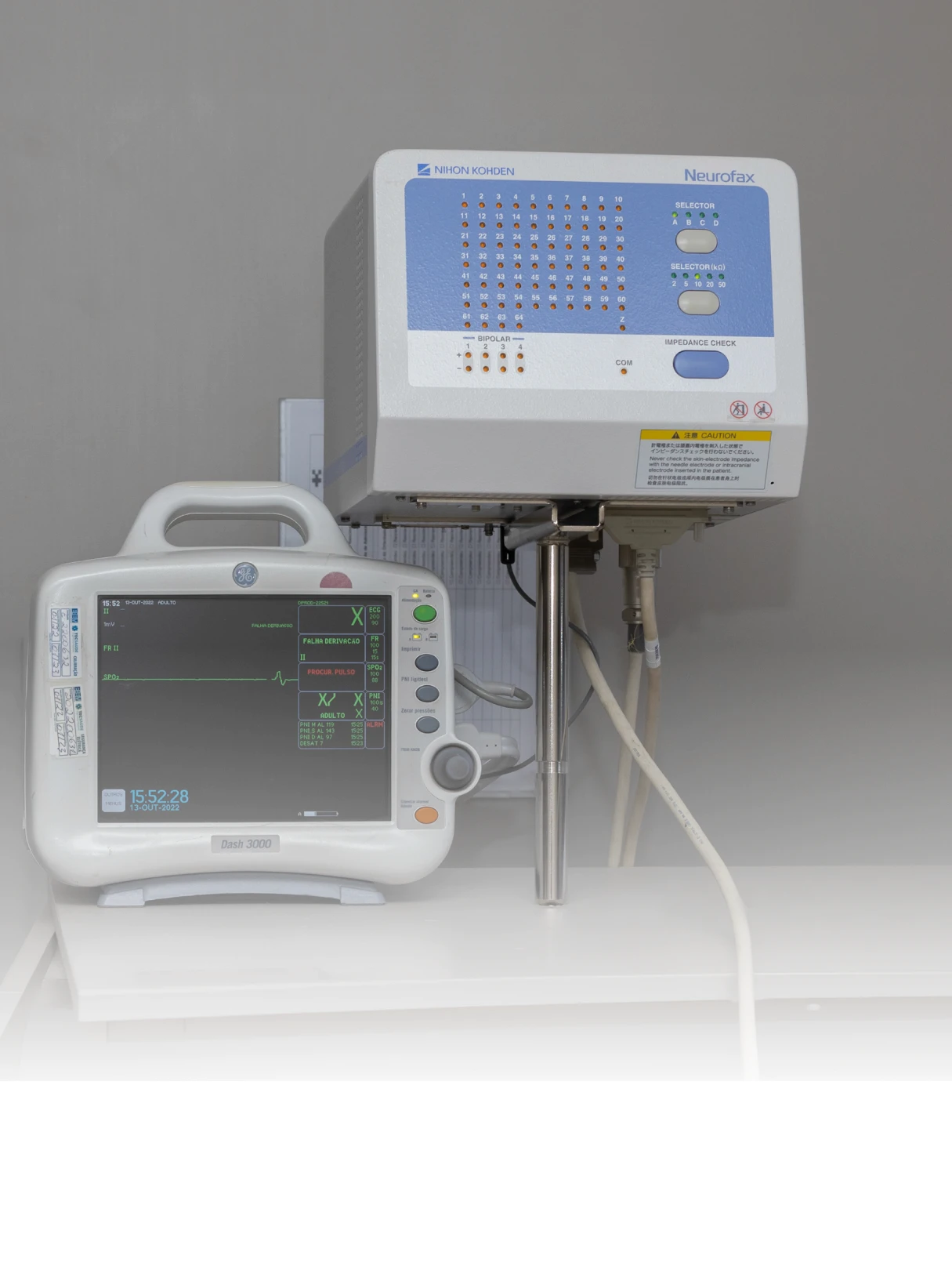 Unidade de monitorização por vídeo-EEG do Centro de Epilepsia do Hospital Santa Lúcia Sul, Brasília