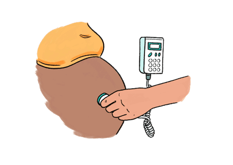 An illustration of a pregnant belly with a hand holding up a monitor device to the belly. The device is attached by wire to a larger monitor display.