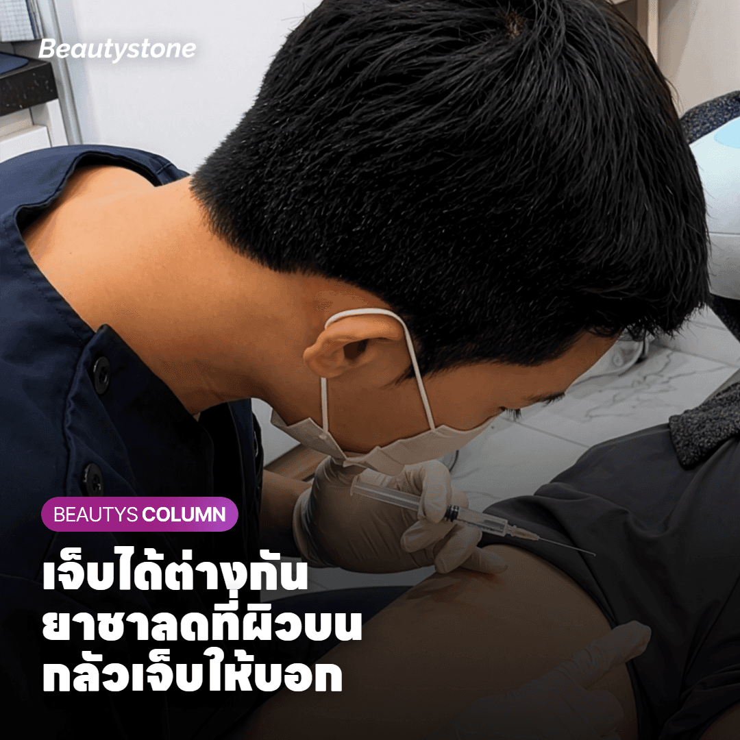 Potenza เจ็บไหม? ยาชาช่วยได้แค่ไหน
