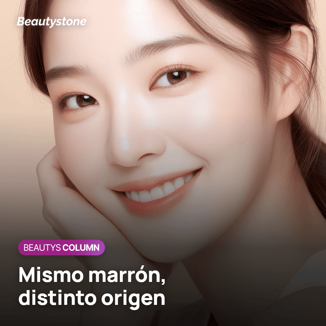 Diferencias entre melasma, manchas pequeñas y manchas de la edad
