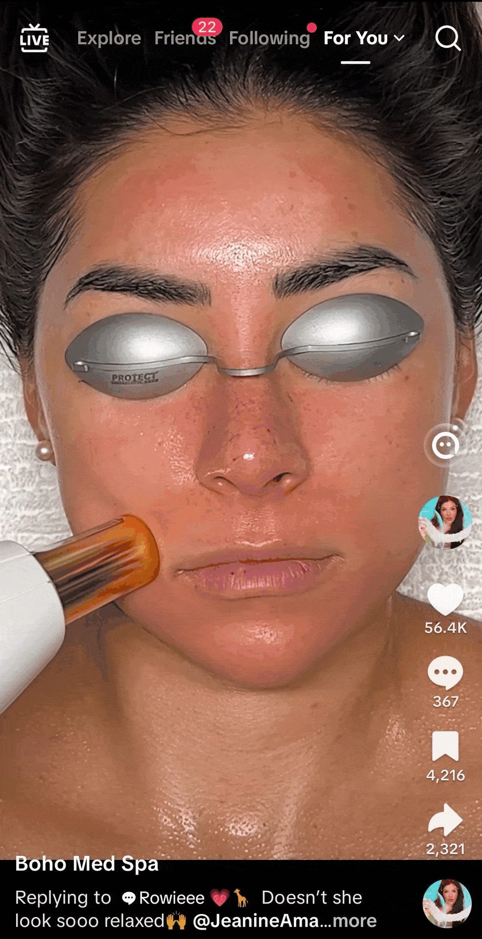 resurfx fractional laser gif for customers