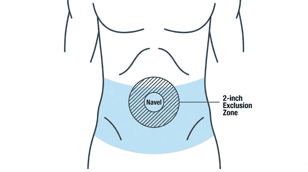 Tirzepatide stomach injection site map showing approved abdomen zones and navel exclusion area