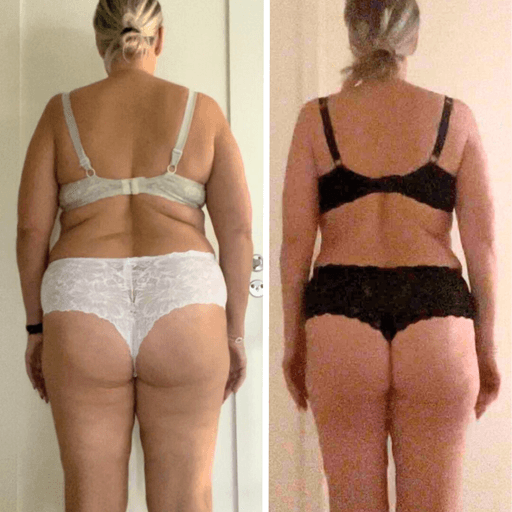 Före- och efterjämförelse av en kvinna som gick ner i vikt med RE:YOU-programmet